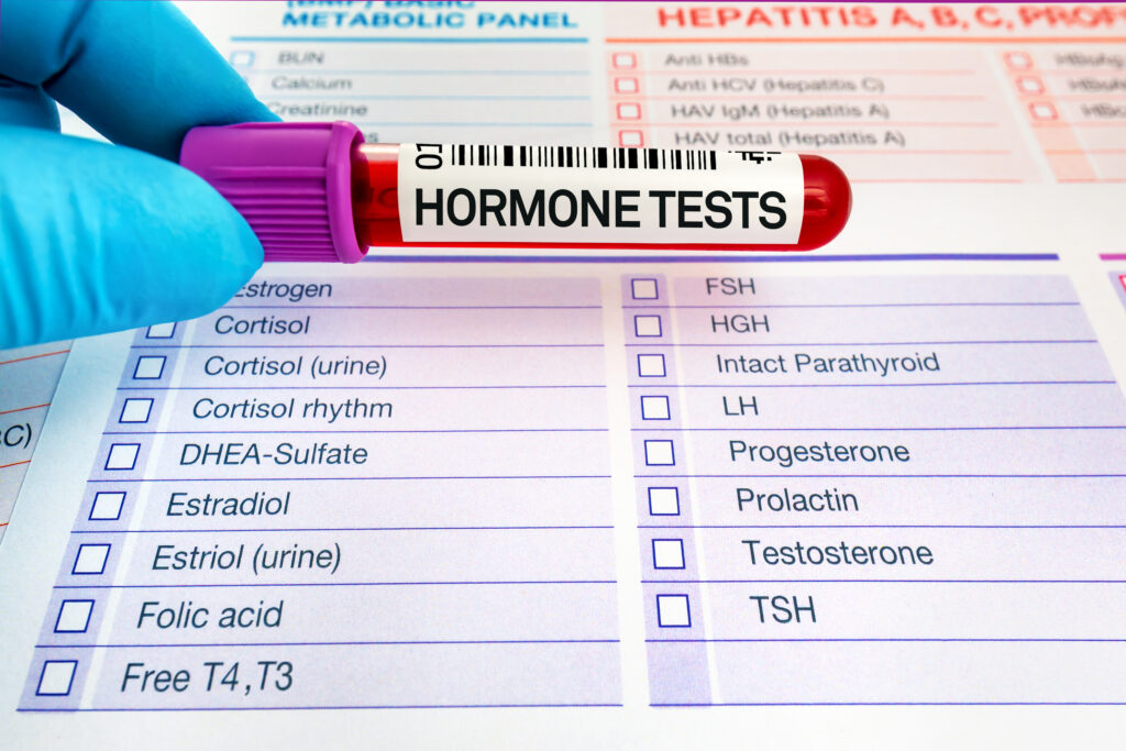 A sample tube labelled hormone tests held by a professional for Hormonal Replacement Therapy