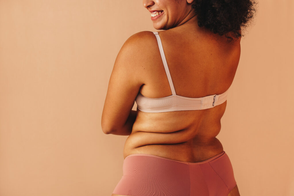 Weightloss Loss Treatments for women