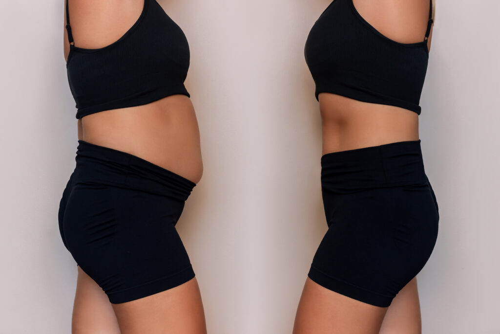 Weight Loss transformation before and after