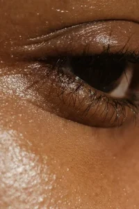 botox+and+filler+treatments+dallas