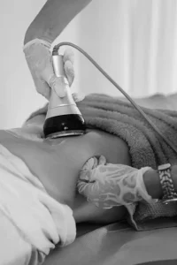 cool+sculpting+in+dallas+texas+for+women