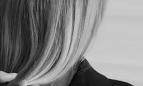 hair-loss-treatment-blog-img-3